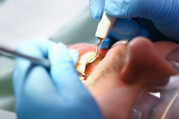 Best Emergency Tooth Extraction in Mckee City, NJ
